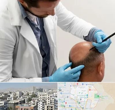 کاشت مو به روش تکثیری در منطقه 14 تهران 