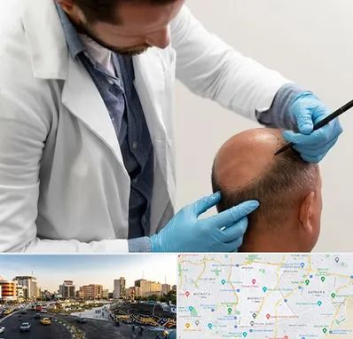 کاشت مو به روش تکثیری در منطقه 7 تهران 