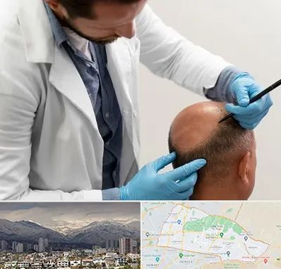 کاشت مو به روش تکثیری در منطقه 4 تهران 