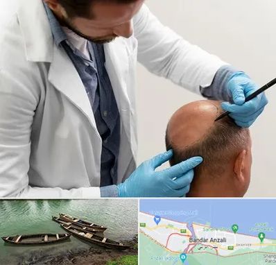 کاشت مو به روش تکثیری در بندر انزلی