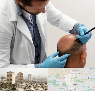 کاشت مو به روش تکثیری در منطقه 5 تهران 