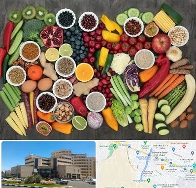 دکتر تغذیه برای چاقی در صیاد شیرازی مشهد