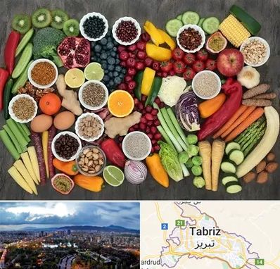 دکتر تغذیه برای چاقی در تبریز