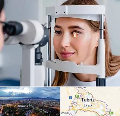 دکتر چشم پزشک خوب در تبریز