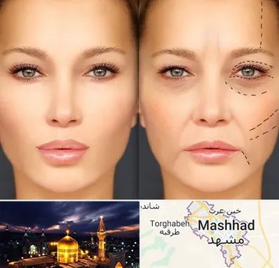 متخصص زیبایی چشم در مشهد