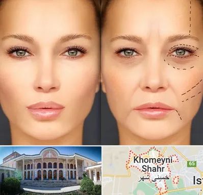 متخصص زیبایی چشم در خمینی شهر