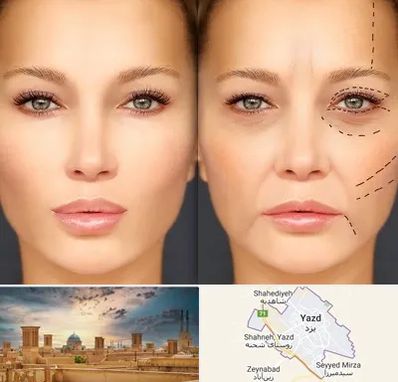 متخصص زیبایی چشم در یزد