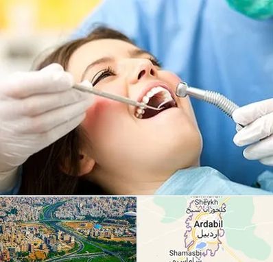 کلینیک دندانپزشکی در اردبیل