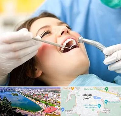 کلینیک دندانپزشکی در لاهیجان
