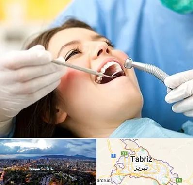 کلینیک دندانپزشکی در تبریز