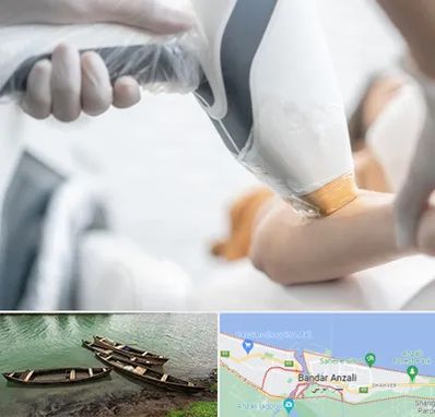 تجهیزات پزشکی زیبایی در بندر انزلی