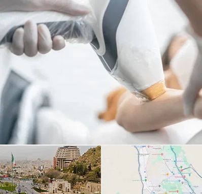 تجهیزات پزشکی زیبایی در فرهنگ شهر شیراز