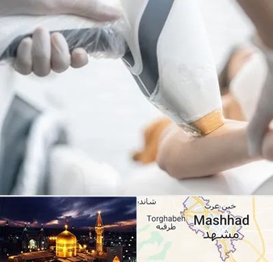 تجهیزات پزشکی زیبایی در مشهد