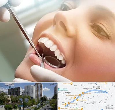 دندانپزشکی زیبایی در اندرزگو