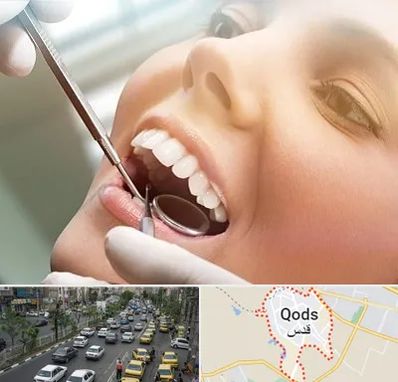 دندانپزشکی زیبایی در شهر قدس