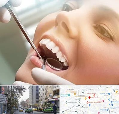 دندانپزشکی زیبایی در فاطمی