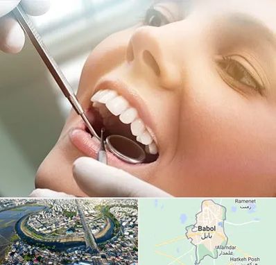 دندانپزشکی زیبایی در بابل