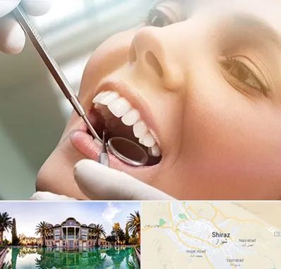 دندانپزشکی زیبایی در شیراز