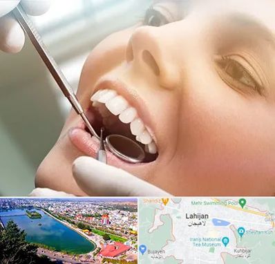 دندانپزشکی زیبایی در لاهیجان