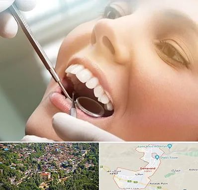دندانپزشکی زیبایی در دماوند