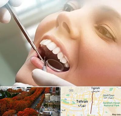 دندانپزشکی زیبایی در ولیعصر
