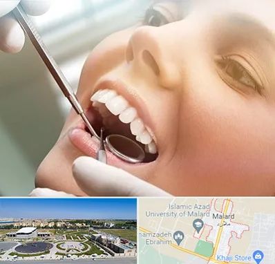 دندانپزشکی زیبایی در ملارد