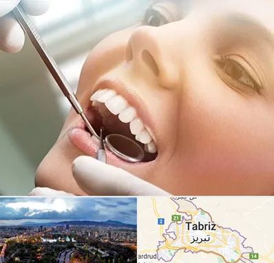 دندانپزشکی زیبایی در تبریز