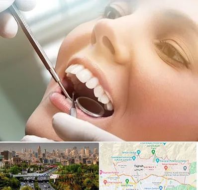 دندانپزشکی زیبایی در منطقه 1 تهران