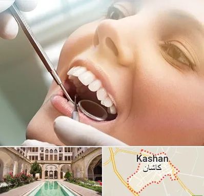 دندانپزشکی زیبایی در کاشان