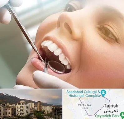 دندانپزشکی زیبایی در زعفرانیه