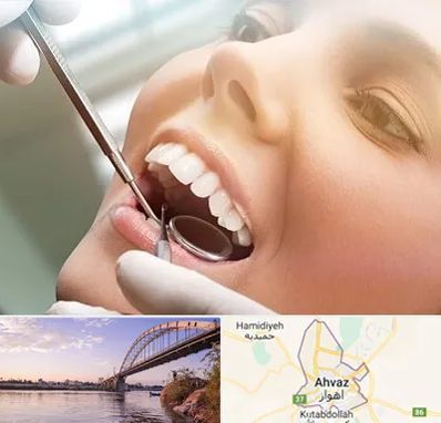دندانپزشکی زیبایی در اهواز