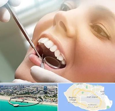 دندانپزشکی زیبایی در کیش