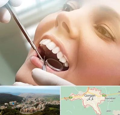 دندانپزشکی زیبایی در گرگان