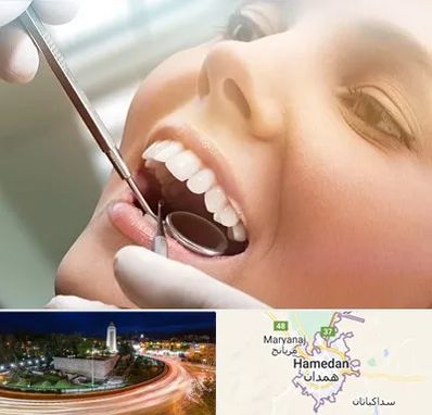 دندانپزشکی زیبایی در همدان