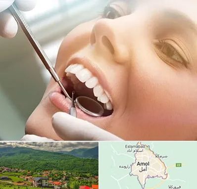 دندانپزشکی زیبایی در آمل