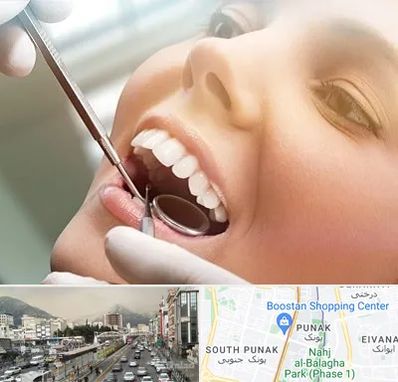 دندانپزشکی زیبایی در پونک