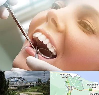 دندانپزشکی زیبایی در چالوس
