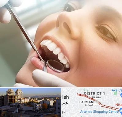 دندانپزشکی زیبایی در فرمانیه