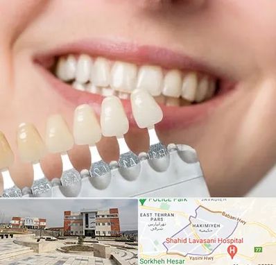 مرکز کامپوزیت دندان در حکیمیه