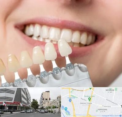 مرکز کامپوزیت دندان در بلوار فردوس