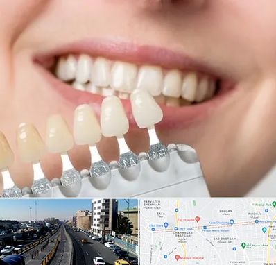 مرکز کامپوزیت دندان در پیروزی