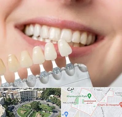 مرکز کامپوزیت دندان در جهانشهر کرج