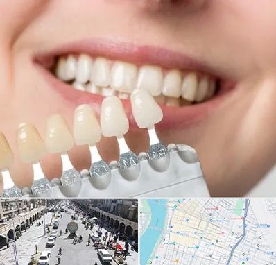 مرکز کامپوزیت دندان در نادری اهواز