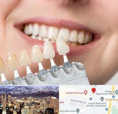 مرکز کامپوزیت دندان در جردن