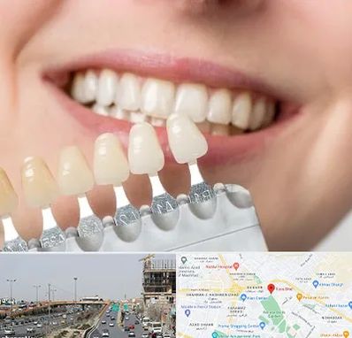 مرکز کامپوزیت دندان در بلوار توس مشهد