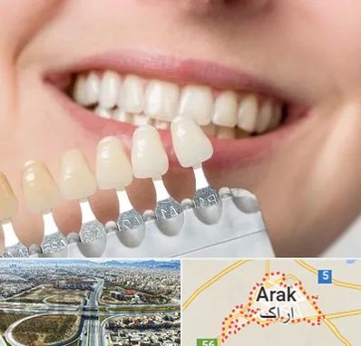 مرکز کامپوزیت دندان در اراک