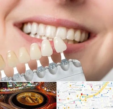 مرکز کامپوزیت دندان در میدان ولیعصر