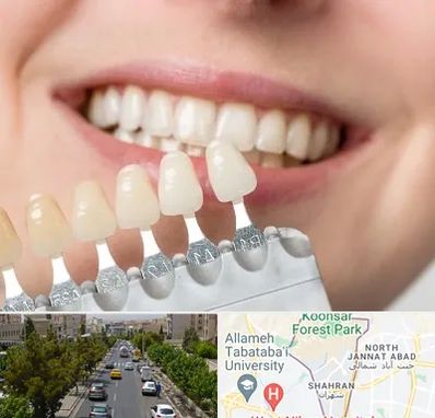 مرکز کامپوزیت دندان در شهران