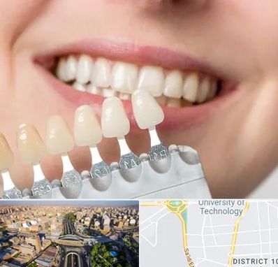 مرکز کامپوزیت دندان در استاد معین