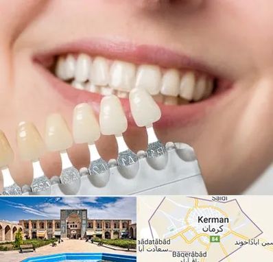 مرکز کامپوزیت دندان در کرمان